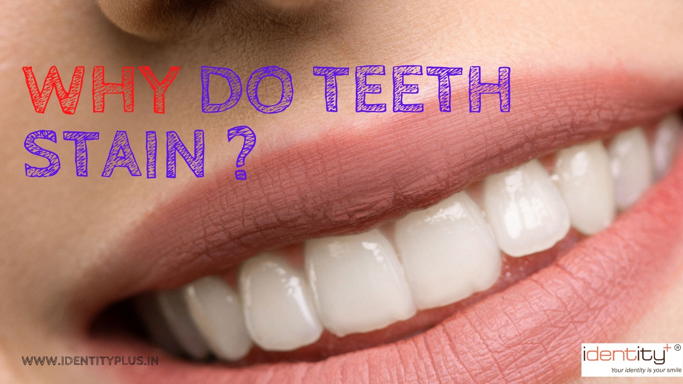 Why do Teeth Stain