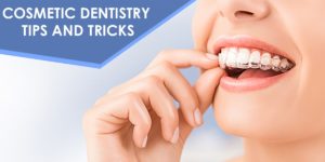 cosmetic-dentistry-tips-tricks-300×150